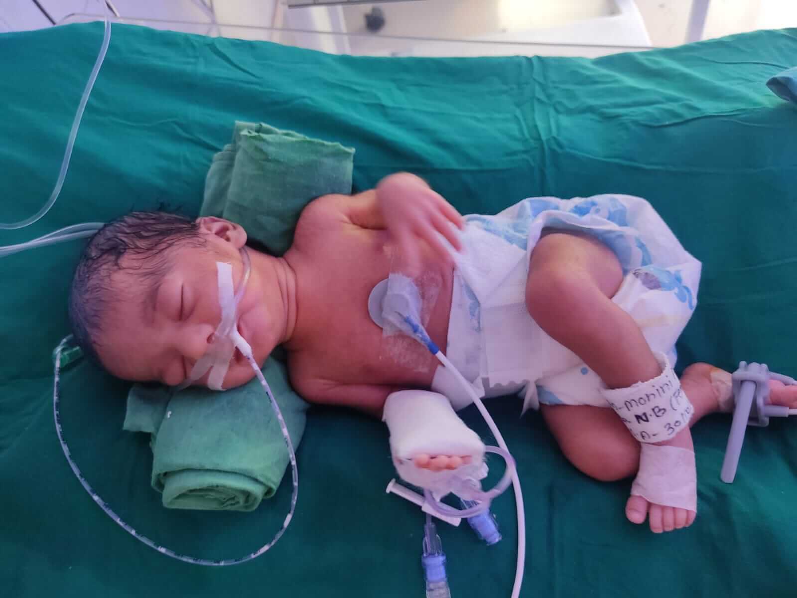 Twin Babies of Mohini Meher