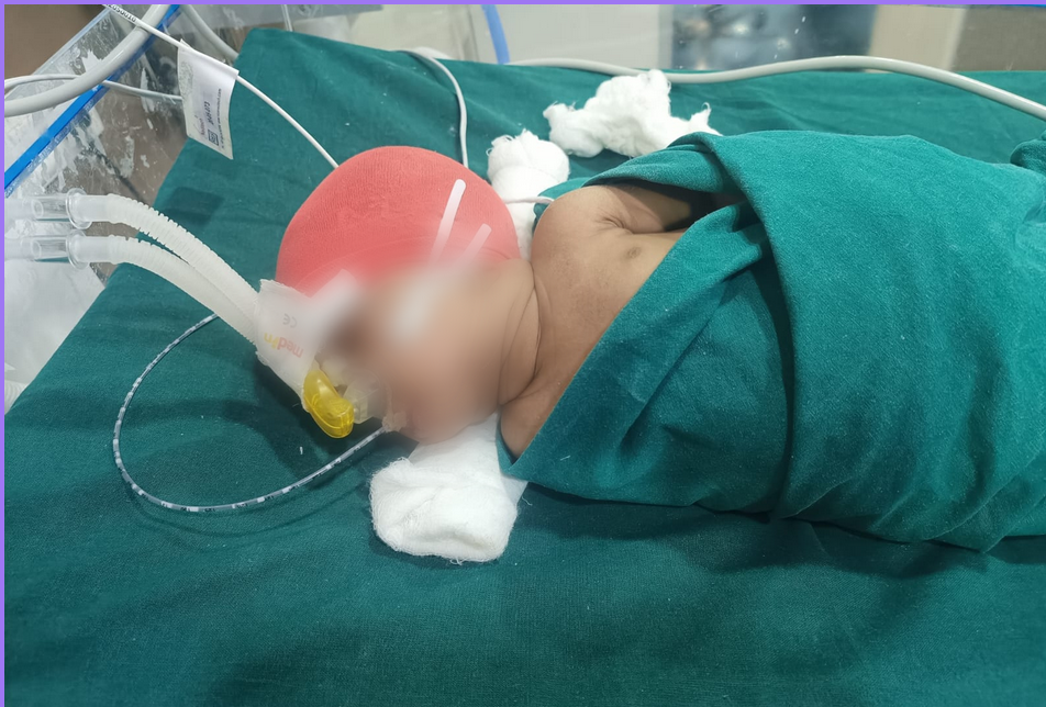 Baby of Mrs. Manorama Yadav