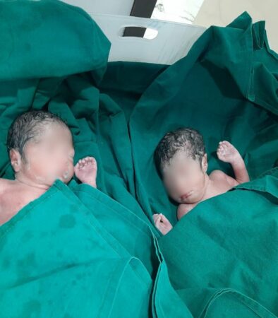 Premature Twin Baby Girls