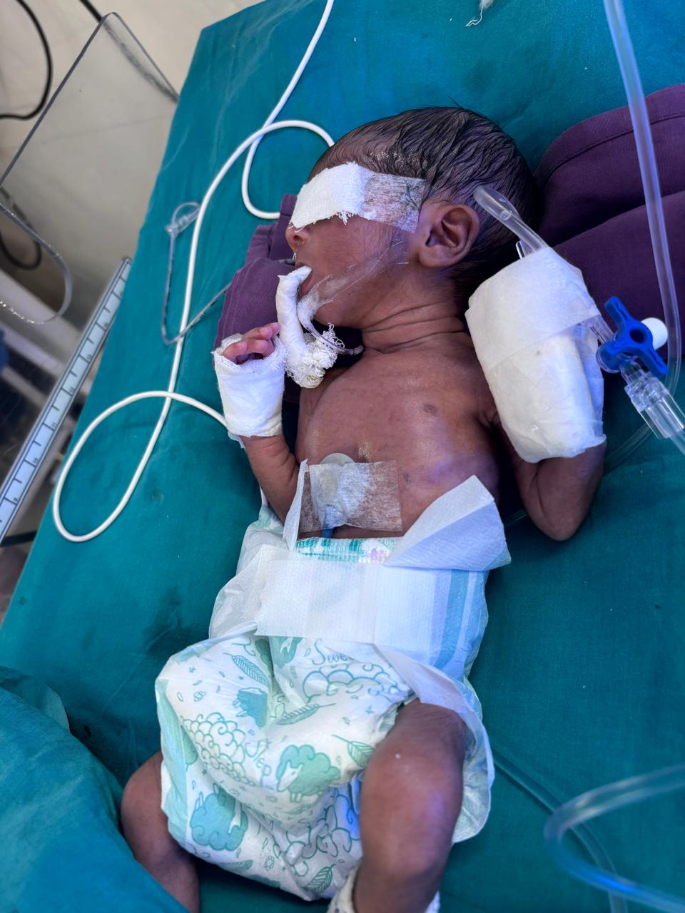 Baby of Nazmin Azim Kalegar