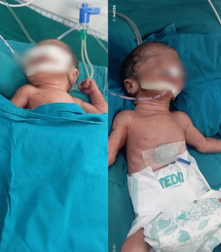 Home Kaniz and Khalil’s Premature Twins